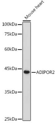 Western Blot: AdipoR2 Antibody [NBP2-92087] - Western blot analysis of extracts of Mouse heart, using AdipoR2 antibody (NBP2-92087) at 1:500 dilution. Secondary antibody: HRP Goat Anti-Rabbit IgG (H+L) at 1:10000 dilution. Lysates/proteins: 25ug per lane. Blocking buffer: 3% nonfat dry milk in TBST. Detection: ECL Basic Kit. Exposure time: 180s.